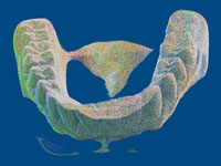 Point Cloud Processing dental cast model